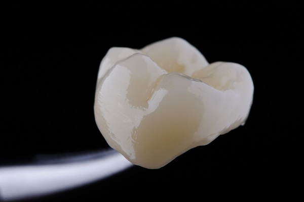 When You May Need Dental Core Buildup Before A Dental Crown