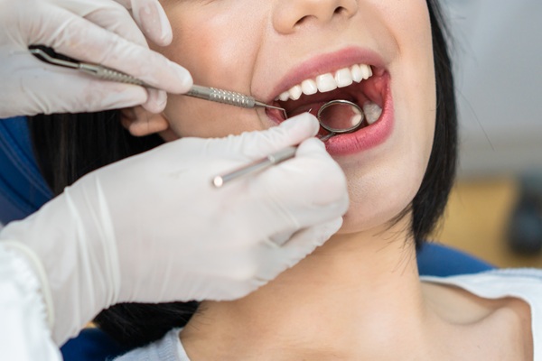 Things To Avoid After Getting A Dental Filling